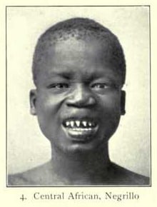 pygmy women teeth