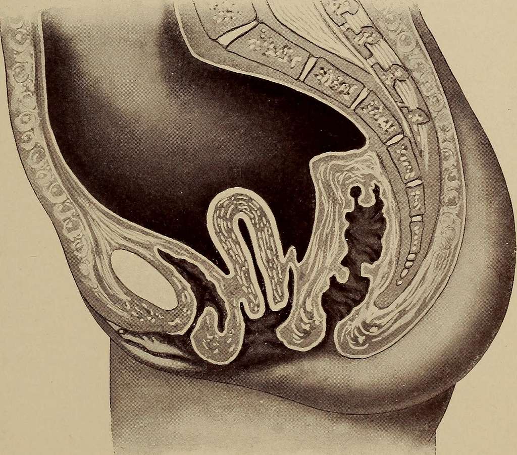 On retro-peritoneal hernia : being the 'Arris and Gale' lectures