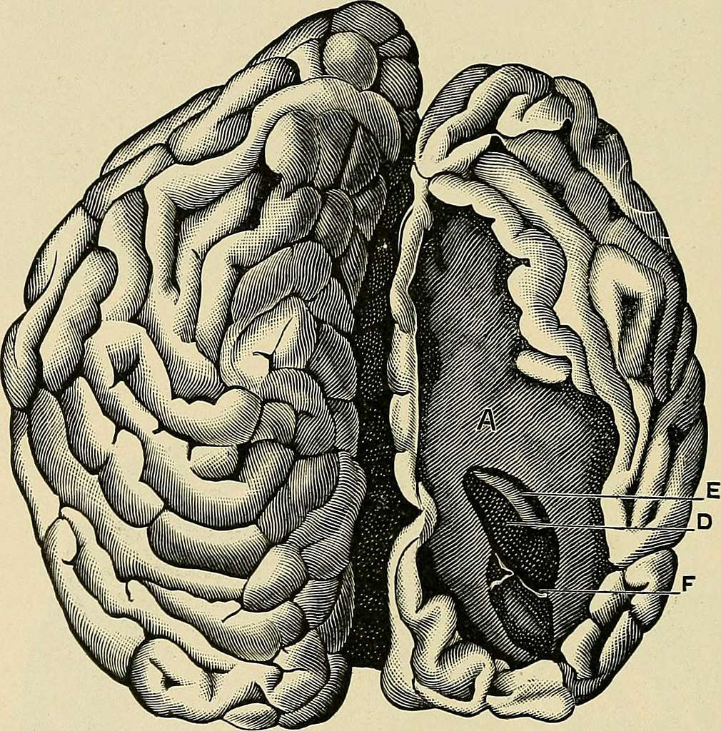 organic-and-functional-nervous-diseases-a-text-book-of-neurology-1913-14779462474-b05568-1024.jpg