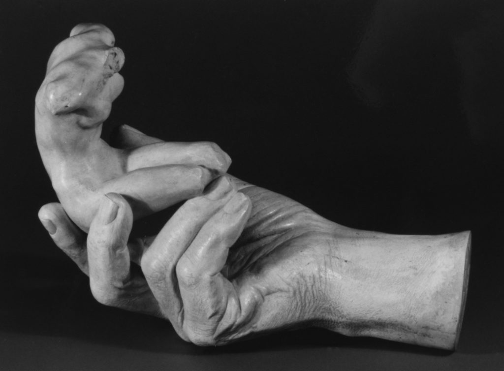 The Real Medical Conditions Behind the Deformed Hands in Rodin's