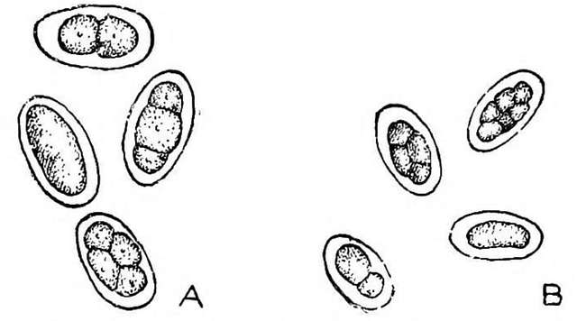 A; Necator Americanus, B Ancylostoma Duodenale Eggs (03) - PICRYL ...