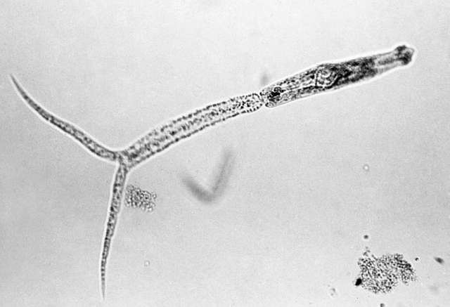 schistosoma japonicum cercariae