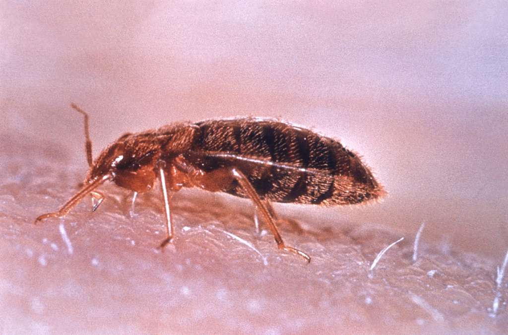 Cimex lectularius - A close up of a bed bug on a person's skin - PICRYL -  Public Domain Media Search Engine Public Domain Image