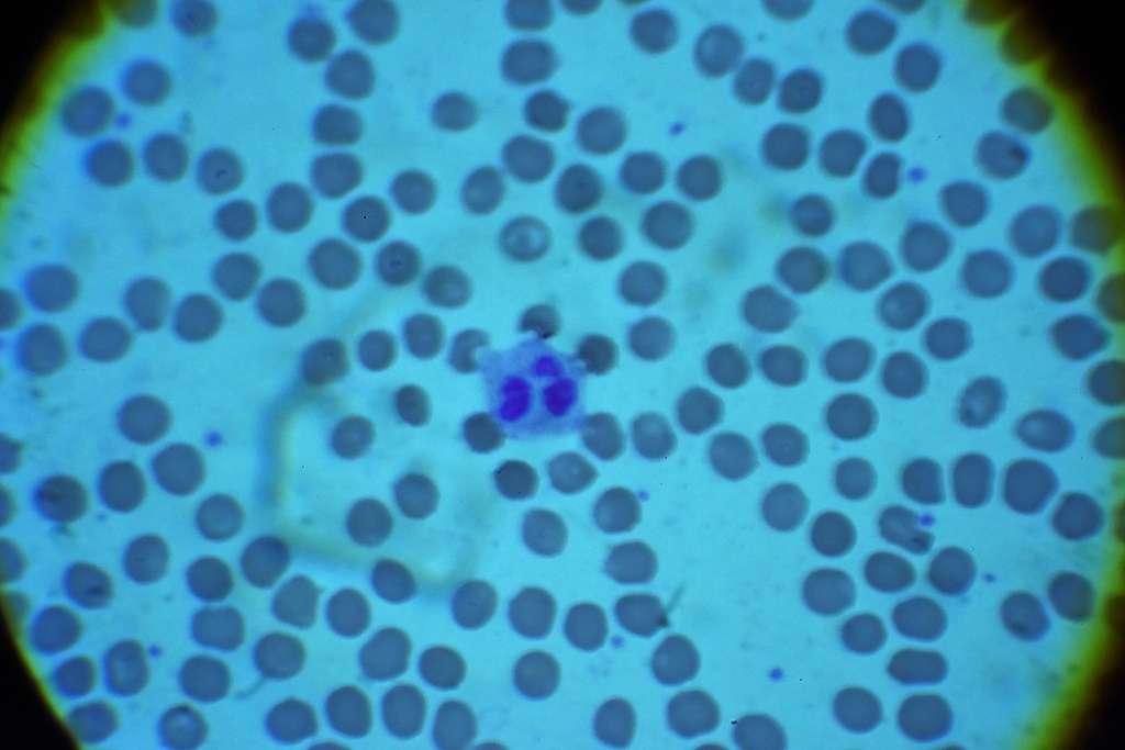 a-white-blood-cell-is-viewed-microscopically-in-a-blood-nara-dvids