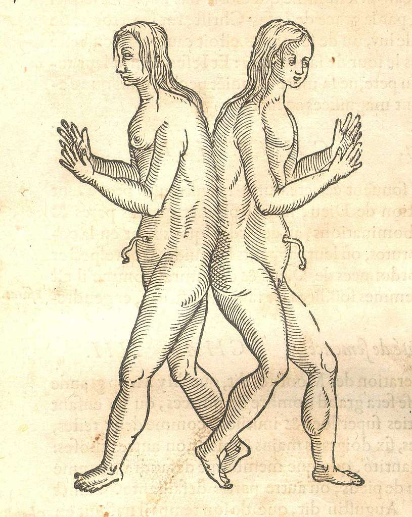 33 Conjoined twins nude Images: PICRYL - Public Domain Media Search Engine  Public Domain Search